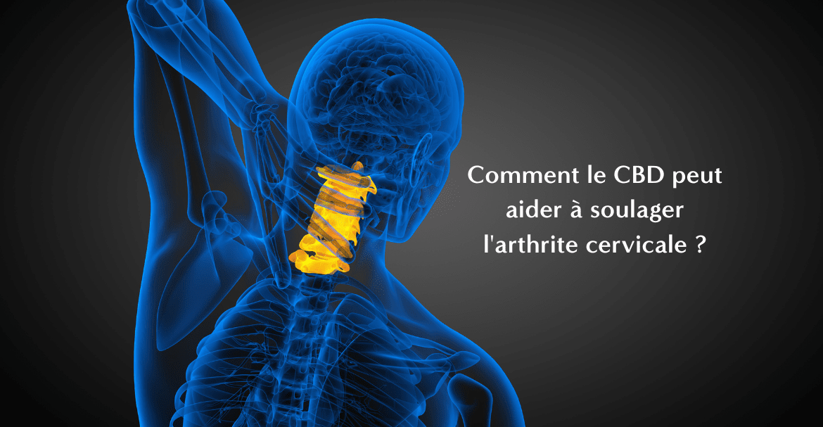 Comment le CBD peut aider à soulager l'arthrite cervicale ?